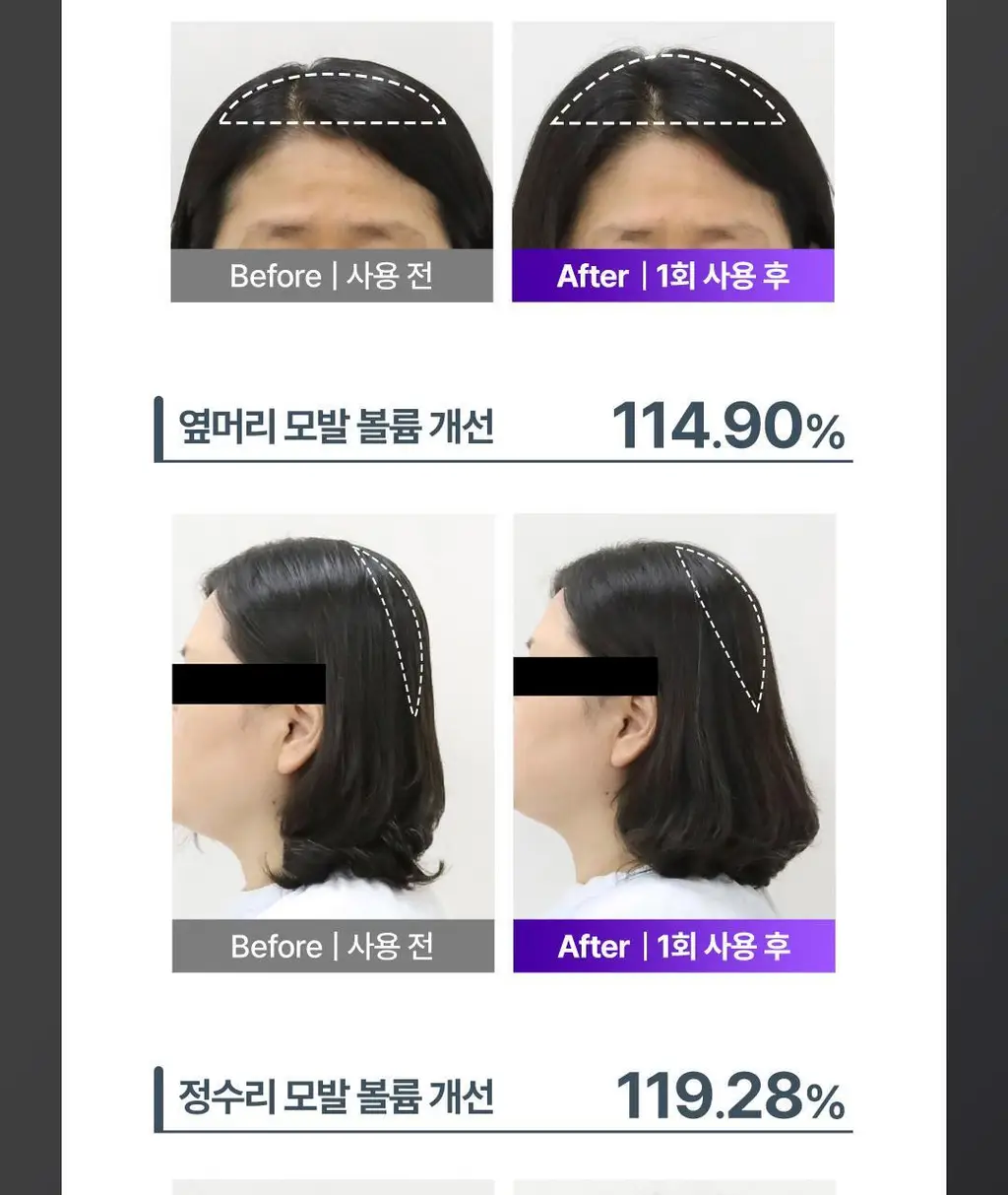 [No.1 헤어/두피 디바이스] 레스노베 하이퍼샷(베이지/핑크) 상세페이지 20